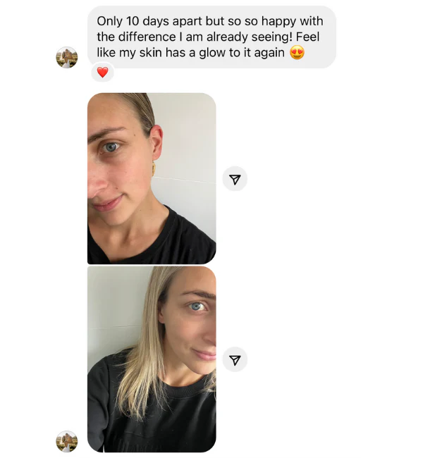 Balance + Brighten Bundle - Image 4