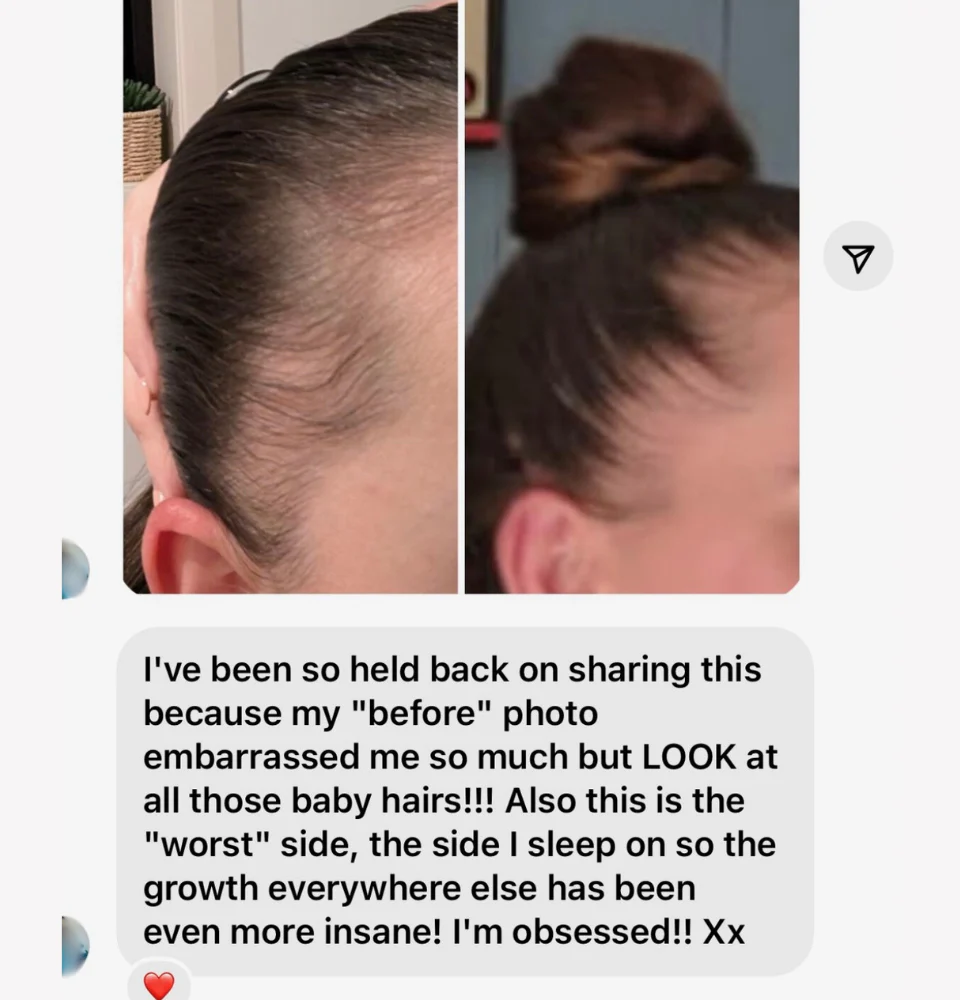 Vita-Growth Scalp Serum - Image 4