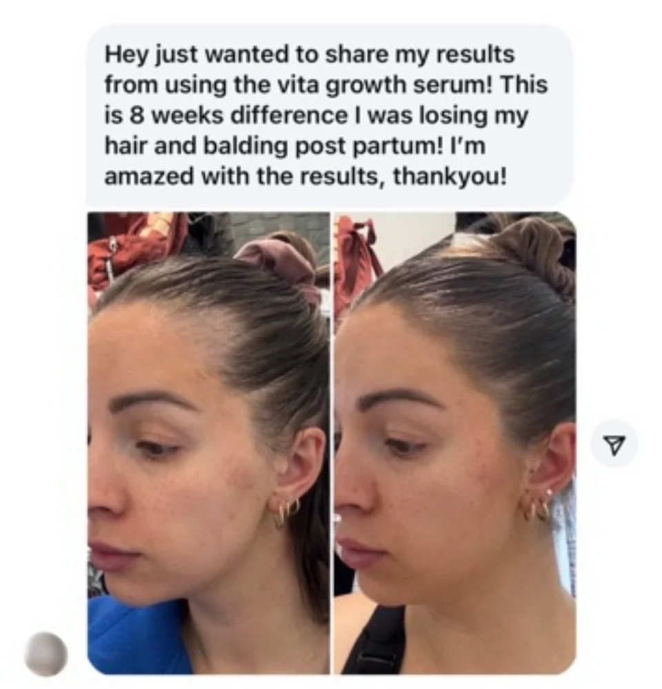 Vita-Growth Scalp Serum - Image 5