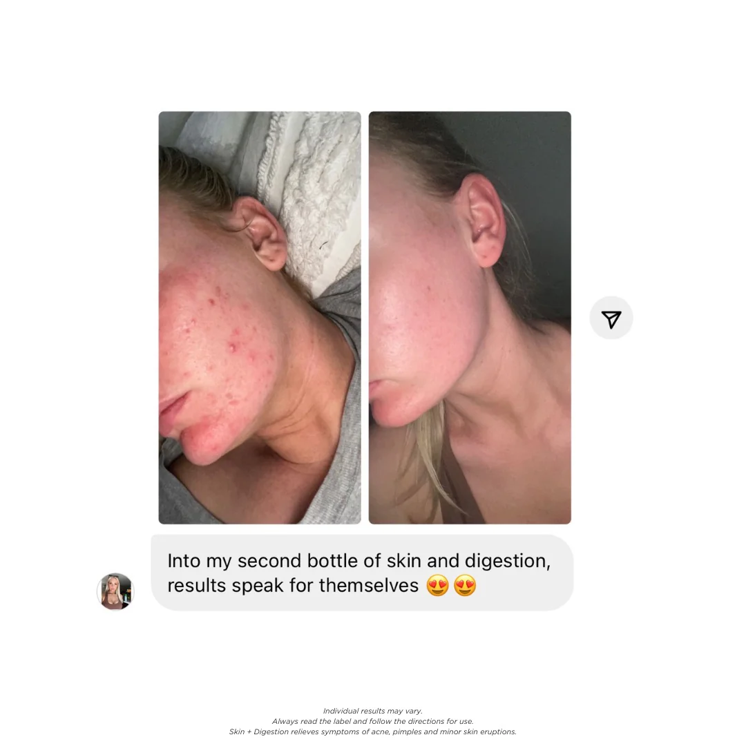 Skin + Digestion Formula - Image 6