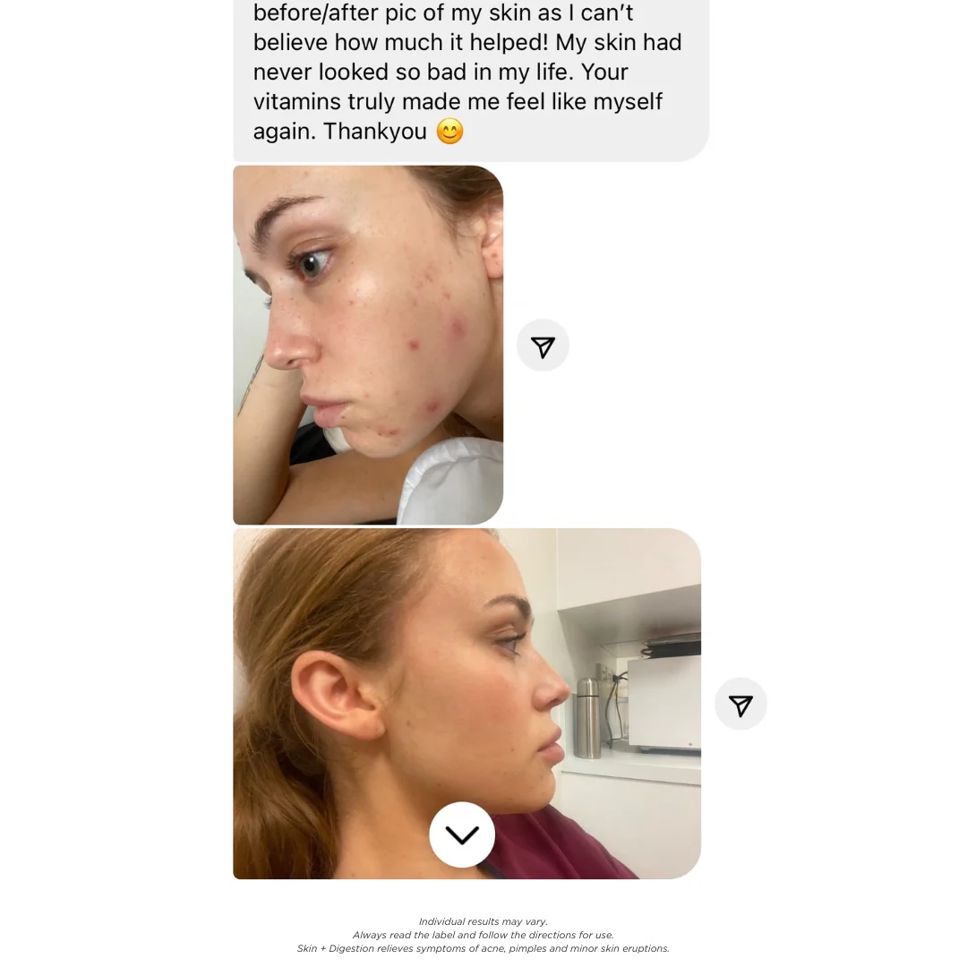 Skin + Digestion Formula - Image 8