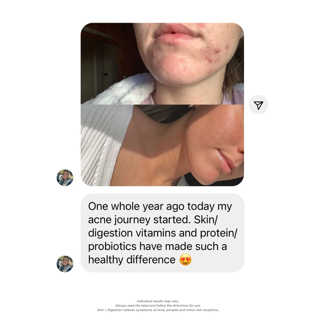 Skin + Digestion Formula - Image 9