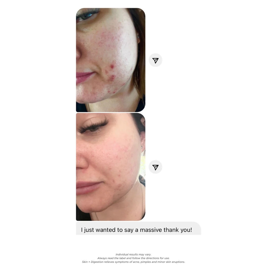 Skin + Digestion Twin Pack - 2 Month Supply - Image 7