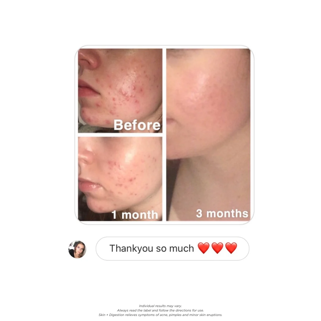 Skin + Digestion Twin Pack - 2 Month Supply - Image 11