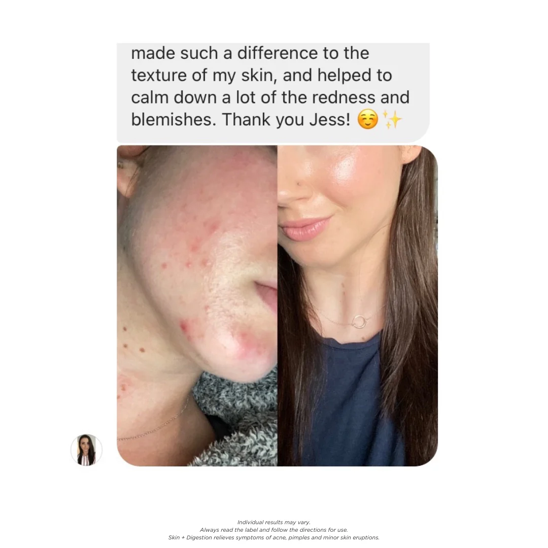 Skin + Digestion Twin Pack - 2 Month Supply - Image 4