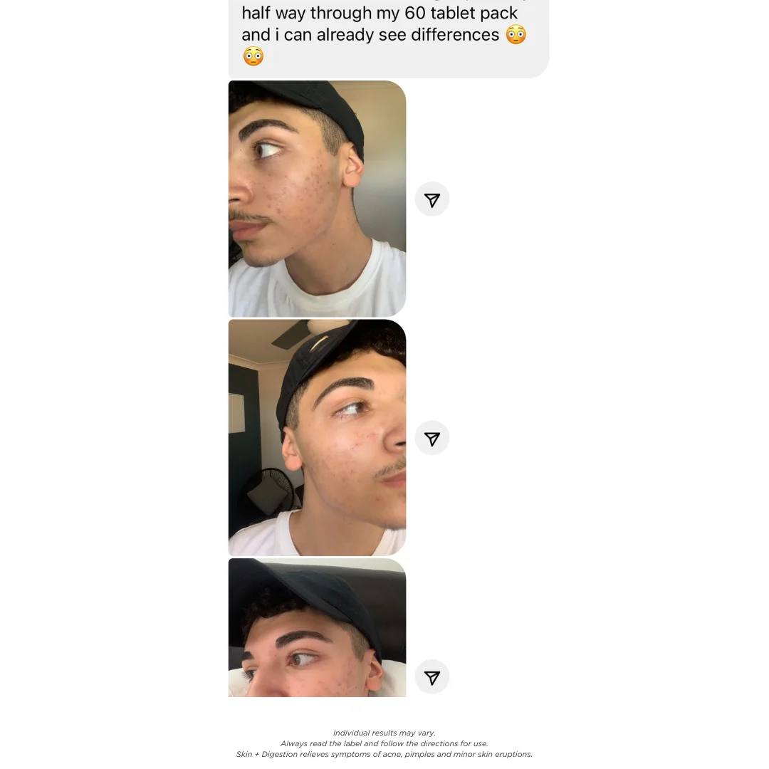 Skin + Digestion Twin Pack - 2 Month Supply - Image 5