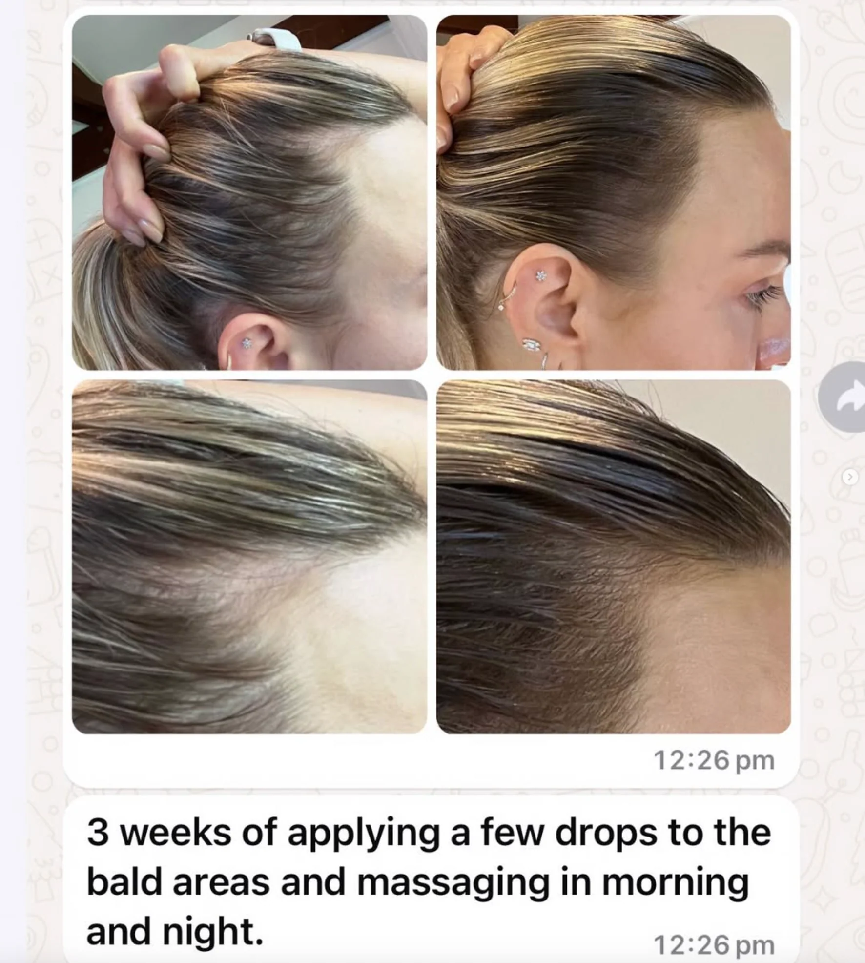 Vita-Growth Scalp Serum - Image 3